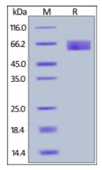 Human Axl, His Tag on SDS-PAGE under reducing (R) condition. The gel was stained overnight with Coomassie Blue. The purity of the protein is greater than 95%.